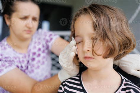 a small childhood infection on the eyelid caused by insect, mosquito or ...