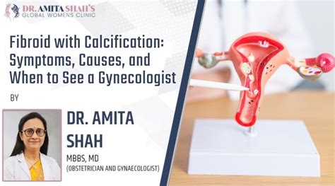 Image result for Calcification Symptoms