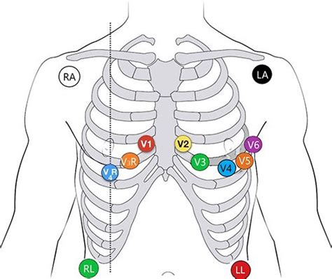 Image result for Lead Optimization Mapper Algorithm