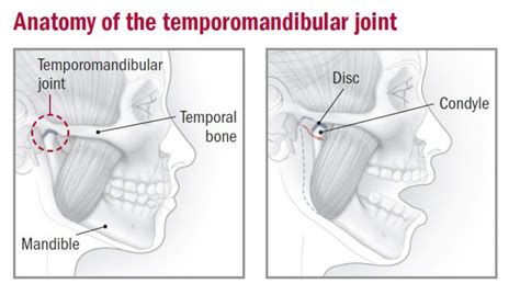 Temporomandibular Joint Disorder Treatment in Gurgaon | PAL Physio