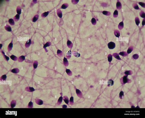 Human Sperm Under Microscope