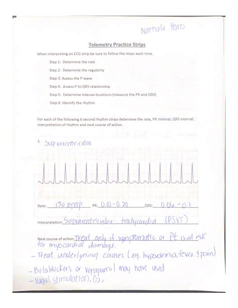 Image result for Telemetry Practice