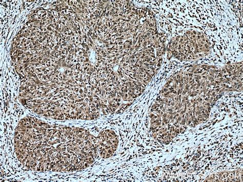 STAT3 antibody (10253-2-AP) | Proteintech