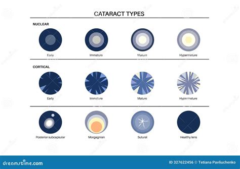 Types of Vision 的图像结果