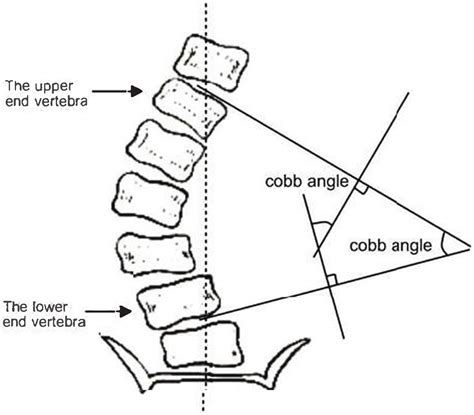 Vertebral Center Points Locating and Cobb Angle Measurement Based on ...
