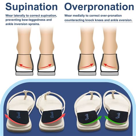 Orthotics For Supinated Feet at JENENGE blog