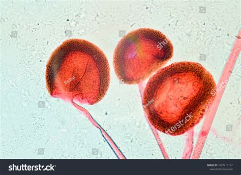 Rhizopus Sporangia Under Microscope Stock Photo 1007415157 | Shutterstock