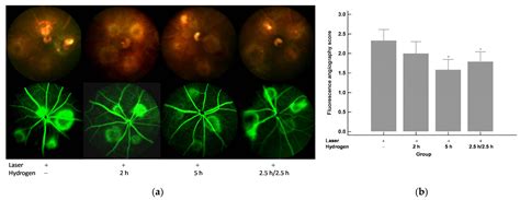 The Anti-Inflammatory Effect of Hydrogen Gas Inhalation and Its ...