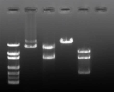 Image result for Restriction Enzyme Mapping