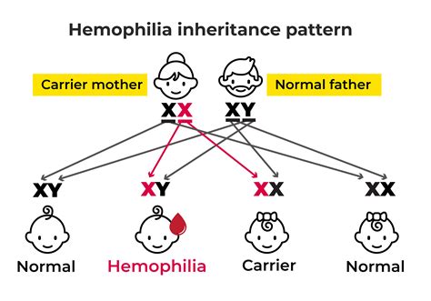 Hemophilia - Inheritance Patterns, Diagnosis, and Medication Options.