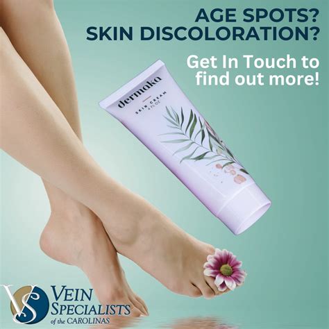 Age Spots, Brown Spots, Skin Discoloration and Recovery! - Vein Specialists of the Carolinas