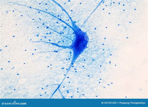 Motor Neuron Under the Microscope. Stock Photo - Image of horn ...