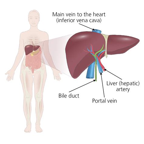 Cadaver Liver Transplant