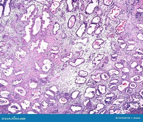 Endometrium. Secretory Phase Stock Illustration - Illustration of reproductive, system: 231620159
