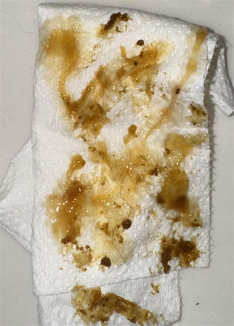 Teeny-tiny strikes of blood in dark mucus on my stool : r/poop