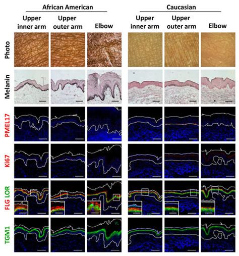 Autophagy Declines with Premature Skin Aging resulting in Dynamic ...