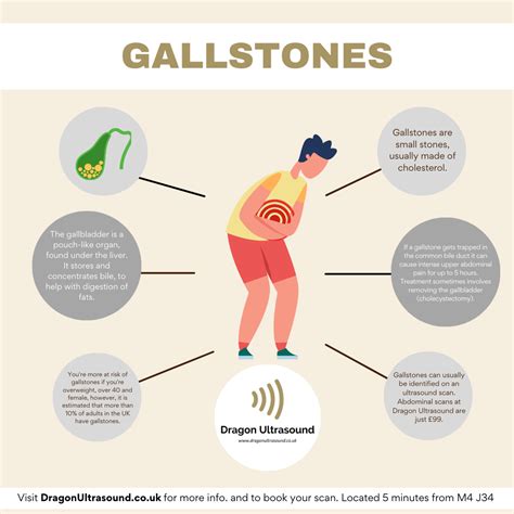 What are gallstones? Dragon Ultrasound | Wales — Dragon Ultrasound