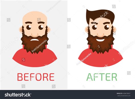 Stages Hair Loss New Before After Stock Vector (Royalty Free) 428678407 ...