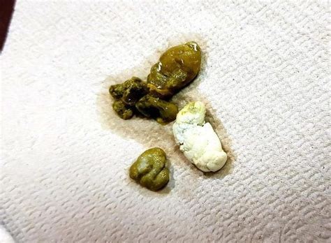 Python Poop 的图像结果