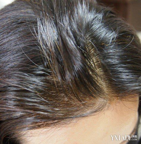 【图】关于头发变白的原因及对策 为你推荐3种治疗方法_伊秀美容网|yxlady.com