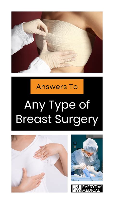 Symptoms of breast implant illness – Artofit