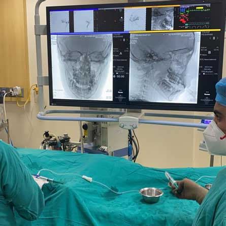 Best Interventional Radiologist in Faridabad | Interventional ...