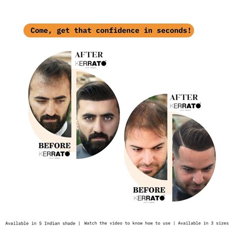 Complementary Pack – Kerrato Hair Fibres