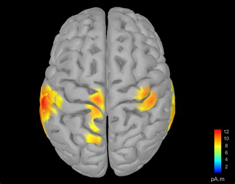 Image result for EEG Source Localization