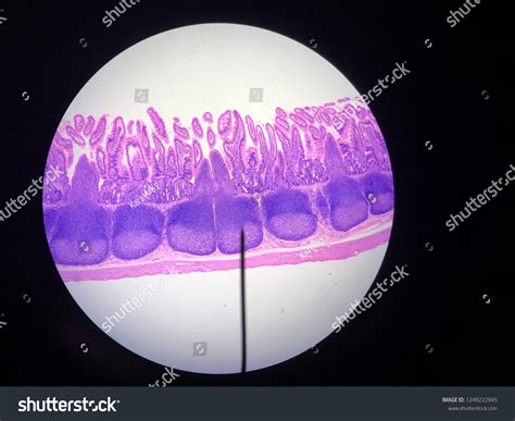 Image result for Small Intestine Jejunum