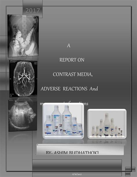 Contrast media - Ac A REPORT ON CONTRAST MEDIA, ADVERSE REACTIONS And ...