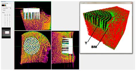 Biomimetic Multispiked Connecting Ti-Alloy Scaffold Prototype for ...