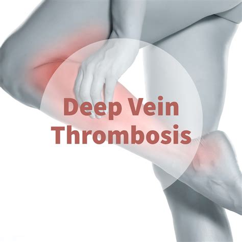 DVT Pain 的图像结果