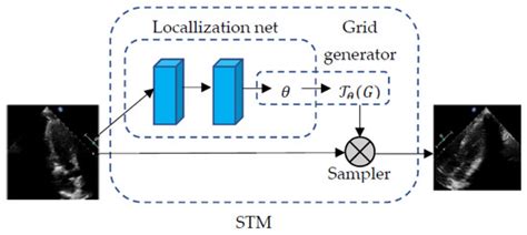 Automated Recognition of Ultrasound Cardiac Views Based on Deep ...