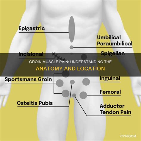 Groin Muscle Pain: Understanding The Anatomy And Location | CyVigor