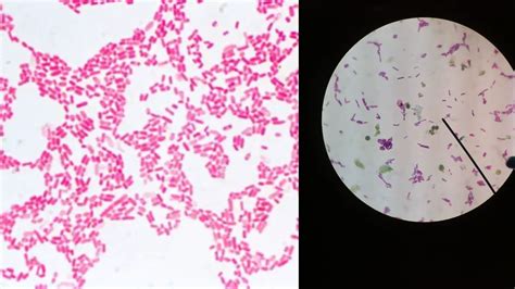 Gram Stain Microscopic Morphology