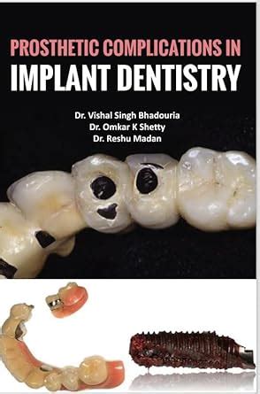 Buy PROSTHETIC COMPLICATIONS IN IMPLANT DENTISTRY Book Online at Low ...