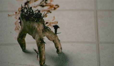 Image result for Splinter in Hand