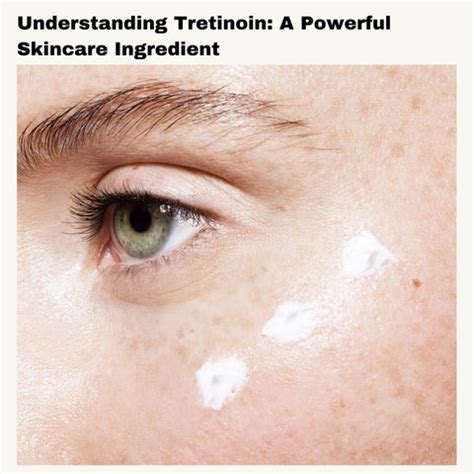 Tretinoin Gel vs Cream: Which Formulation Is Best? | Clinikally