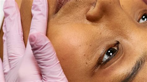 Mini Microcurrent 的图像结果