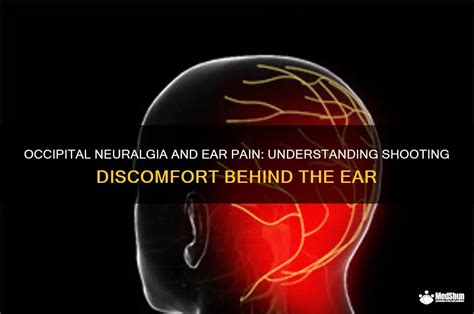 Occipital Neuralgia And Ear Pain: Understanding Shooting Discomfort ...
