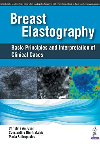 Buy Breast Elastography: Basic Principles and Interpretation of ...
