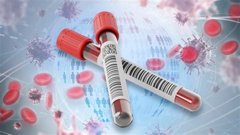 Image result for Blood Circulation Testing