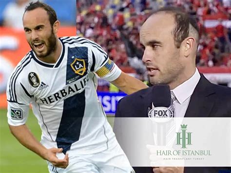 Landon Donovan Hair Transplant Exploring His Hair Revival