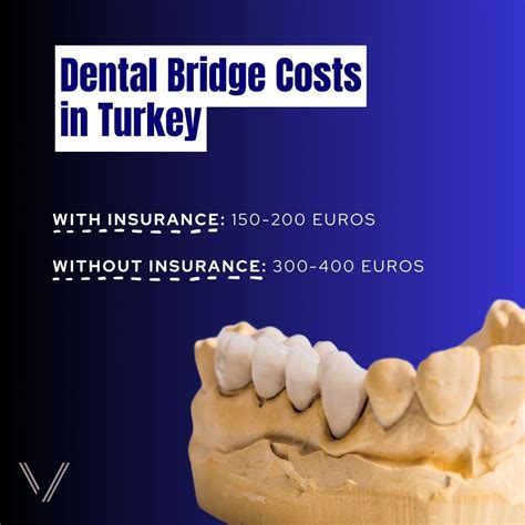 Dental Bridge in Turkey - Costs and Types | 2025 Costs