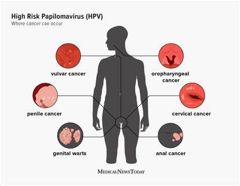 High risk HPV: Types, treatments, and more