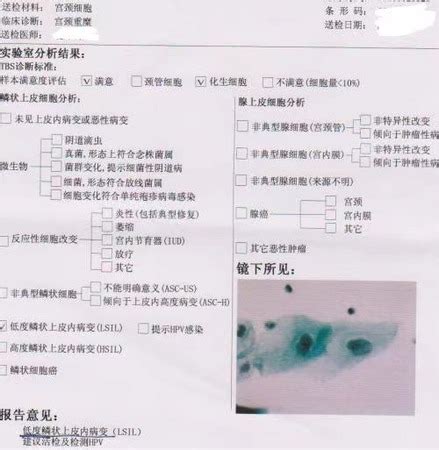 干货！教你如何看懂TCT检查报告单 - 广州市赛凌医药科技有限公司