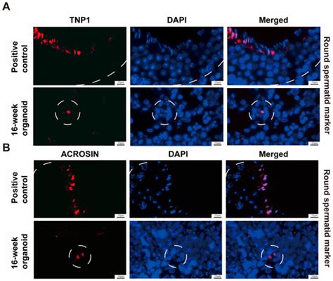 Establishment and Characterization of Testis Organoids with ...