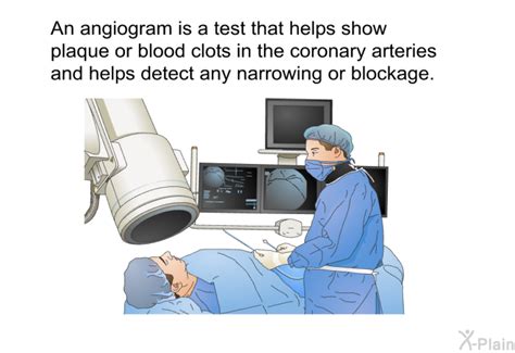 Image result for How Angiogram Is Done