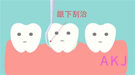 用什么方法能保住松动的牙齿？ - 知乎