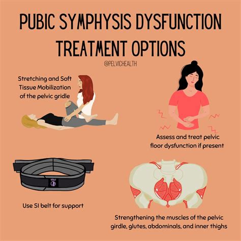 How to deal with Pubic Symphysis Dysfunction | Pelvic Health and Rehabilitation Center posted on ...